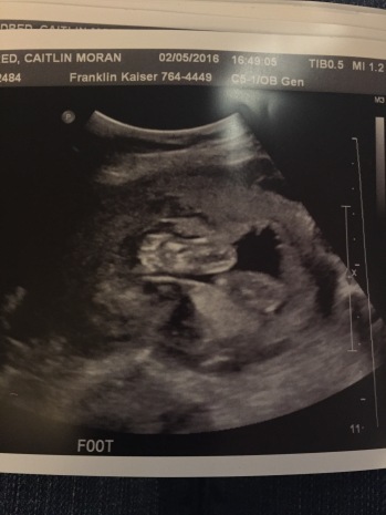 Baby K's tiny foot -- we saw all kinds of legs and feet at our ultrasound!